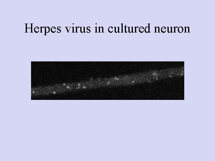 Herpes virus in cultured neuron 