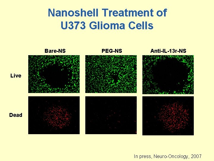 Nanoshell Treatment of U 373 Glioma Cells Bare-NS PEG-NS Anti-IL-13 r-NS Live Dead In