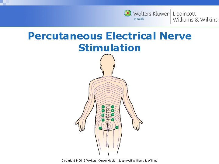 Percutaneous Electrical Nerve Stimulation Copyright © 2013 Wolters Kluwer Health | Lippincott Williams &