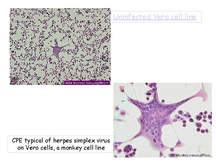 Uninfected Vero cell line CPE typical of herpes simplex virus on Vero cells, a
