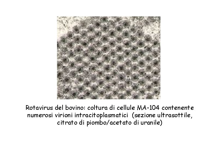 Rotavirus del bovino: coltura di cellule MA-104 contenente numerosi virioni intracitoplasmatici (sezione ultrasottile, citrato