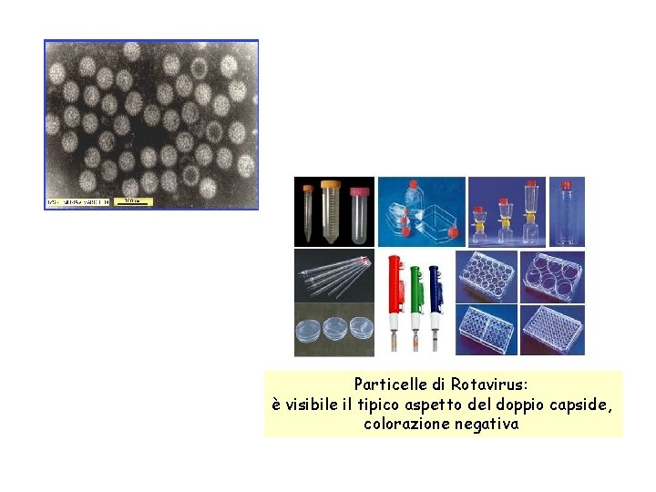 Particelle di Rotavirus: è visibile il tipico aspetto del doppio capside, colorazione negativa 