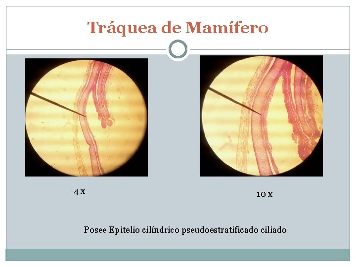 Tráquea de Mamífero 4 x 10 x Posee Epitelio cilíndrico pseudoestratificado ciliado 