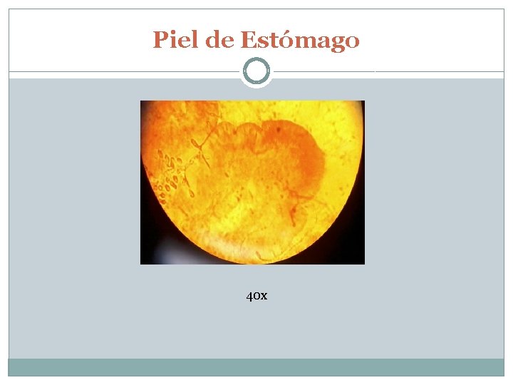 Piel de Estómago 40 x 