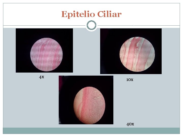 Epitelio Ciliar 4 x 10 x 40 x 