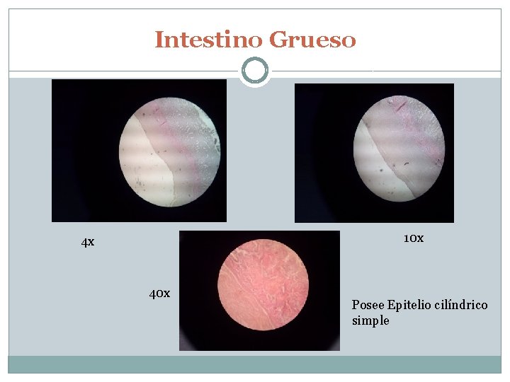 Intestino Grueso 10 x 4 x 40 x Posee Epitelio cilíndrico simple 