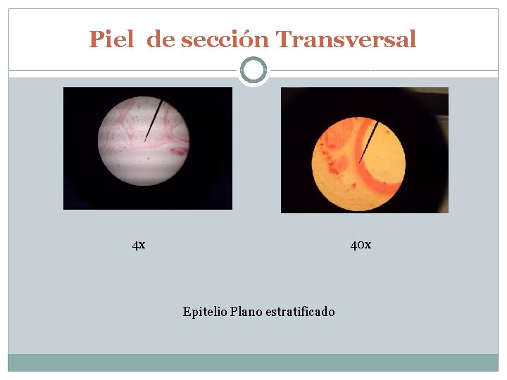 Piel de sección Transversal 4 x 40 x Epitelio Plano estratificado 