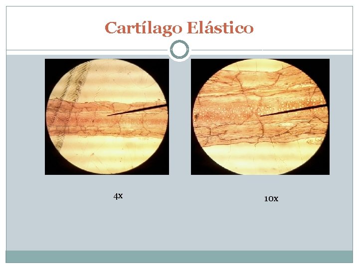 Cartílago Elástico 4 x 10 x 