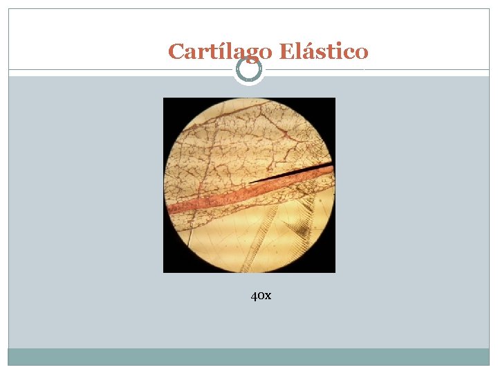 Cartílago Elástico 40 x 