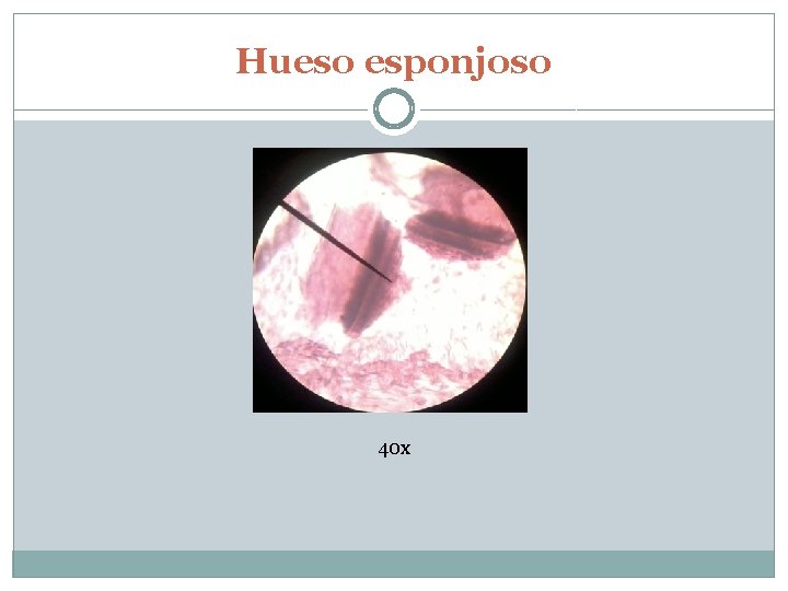 Hueso esponjoso 40 x 