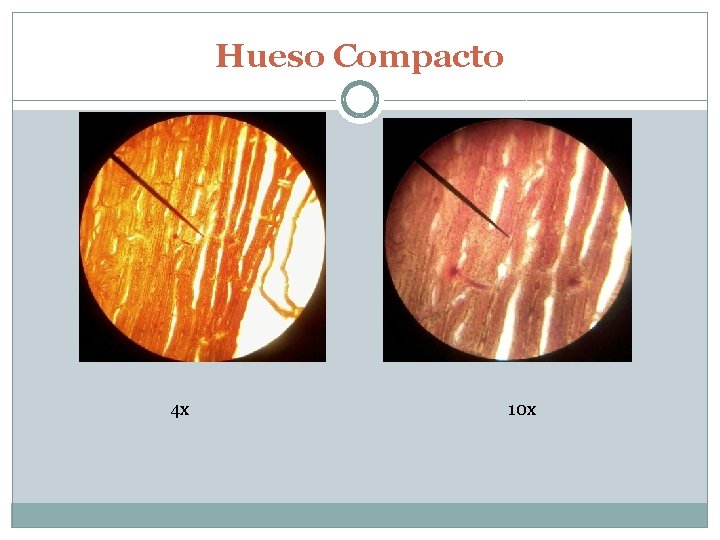 Hueso Compacto 4 x 10 x 