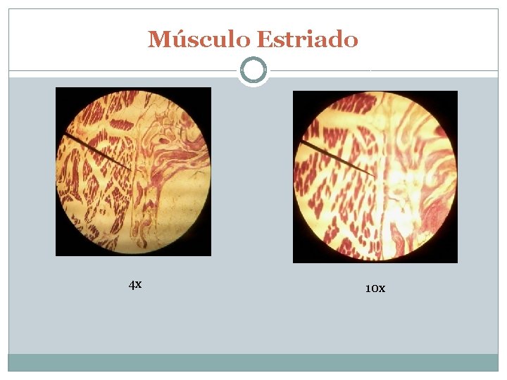 Músculo Estriado 4 x 10 x 
