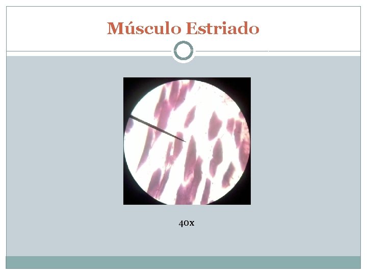 Músculo Estriado 40 x 