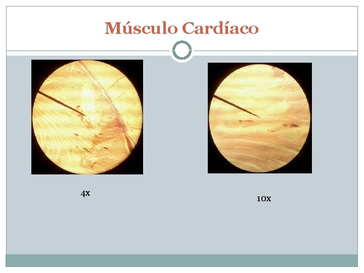 Músculo Cardíaco 4 x 10 x 