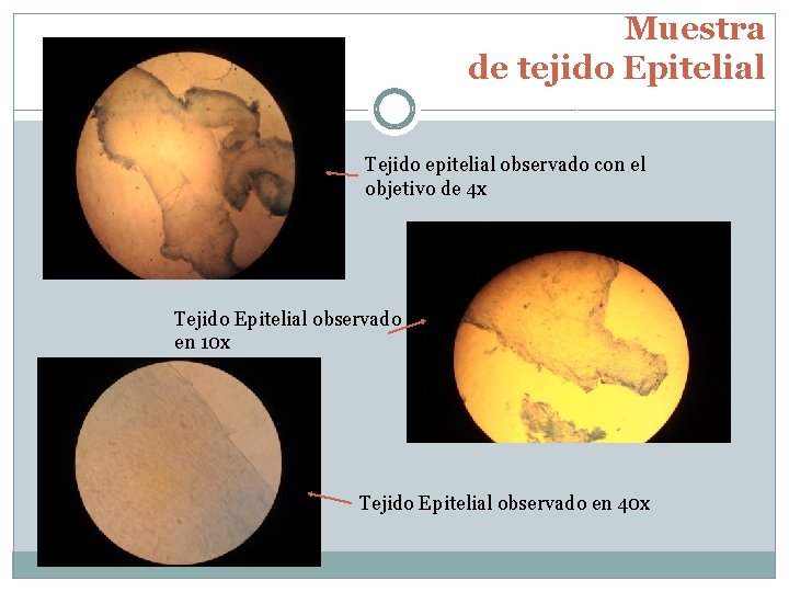 Muestra de tejido Epitelial Tejido epitelial observado con el objetivo de 4 x Tejido