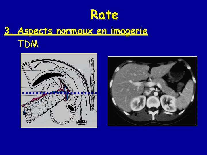 Rate 3. Aspects normaux en imagerie TDM 