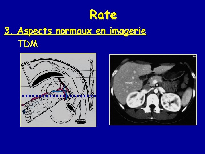 Rate 3. Aspects normaux en imagerie TDM 