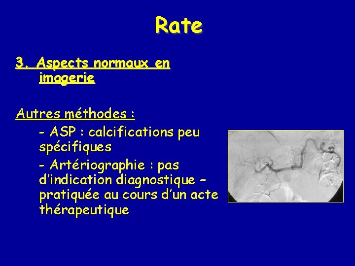 Rate 3. Aspects normaux en imagerie Autres méthodes : - ASP : calcifications peu