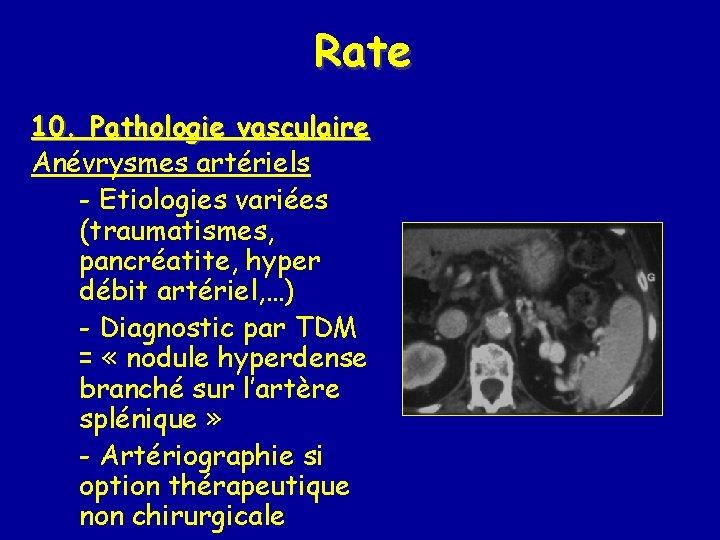 Rate 10. Pathologie vasculaire Anévrysmes artériels - Etiologies variées (traumatismes, pancréatite, hyper débit artériel,