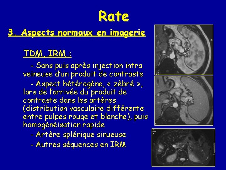 Rate 3. Aspects normaux en imagerie TDM, IRM : - Sans puis après injection