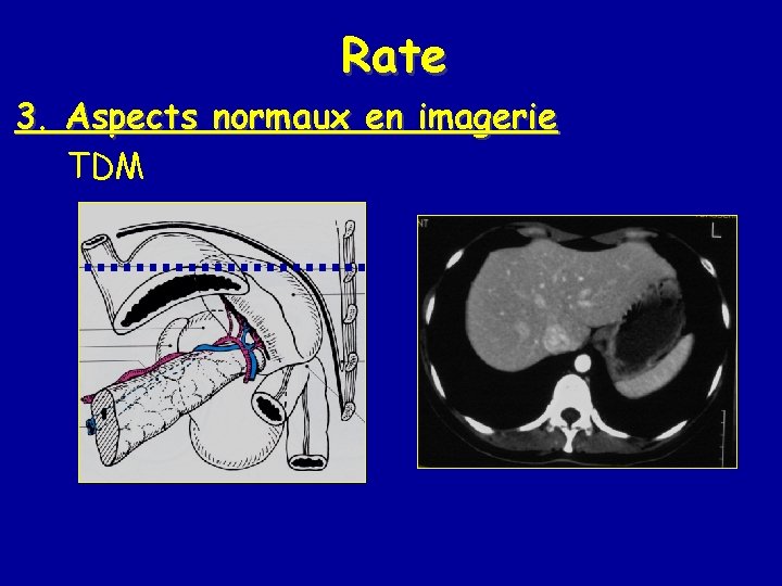 Rate 3. Aspects normaux en imagerie TDM 
