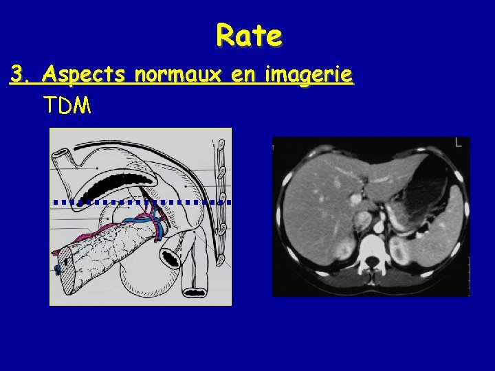 Rate 3. Aspects normaux en imagerie TDM 