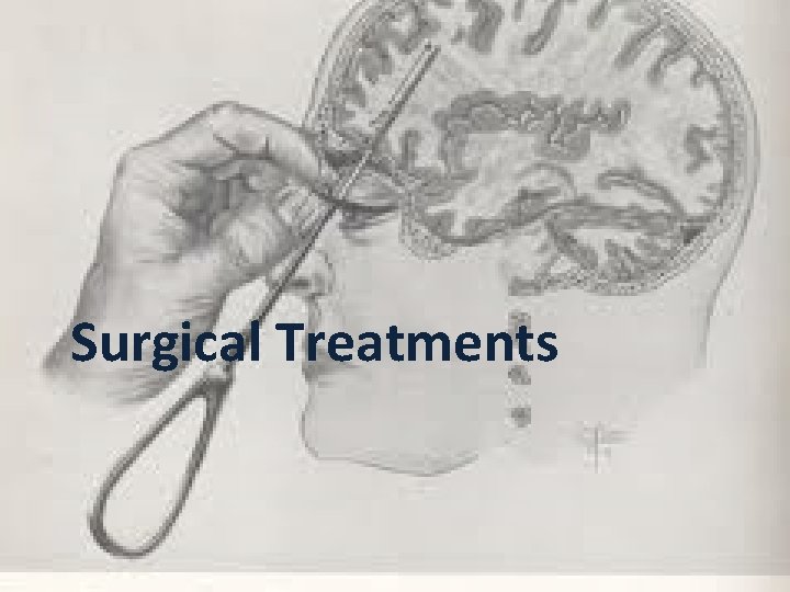 Surgical Treatments 
