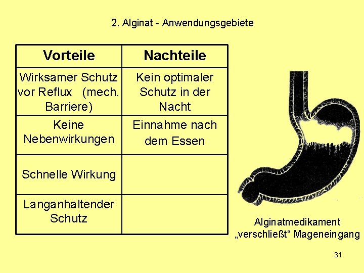 2. Alginat - Anwendungsgebiete Vorteile Nachteile Wirksamer Schutz vor Reflux (mech. Barriere) Kein optimaler