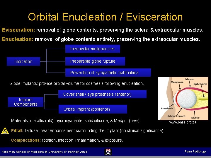 Orbital Enucleation / Evisceration: removal of globe contents, preserving the sclera & extraocular muscles.