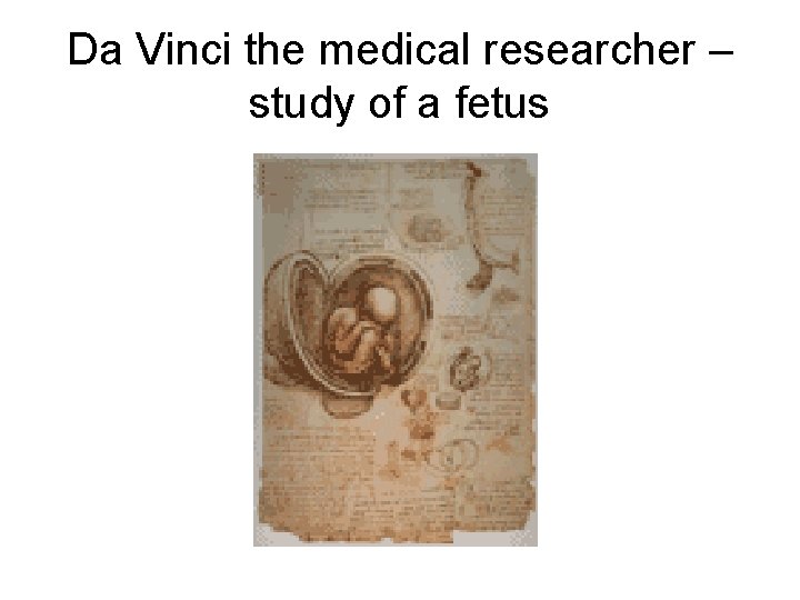 Da Vinci the medical researcher – study of a fetus 