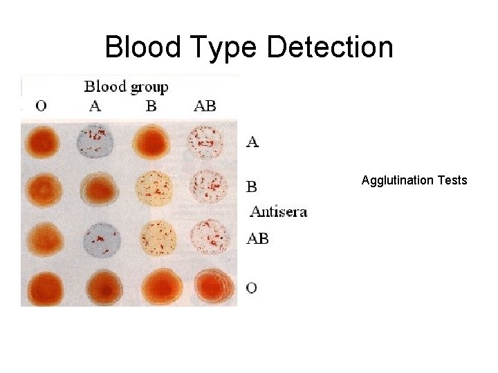 Blood Type Detection Agglutination Tests 