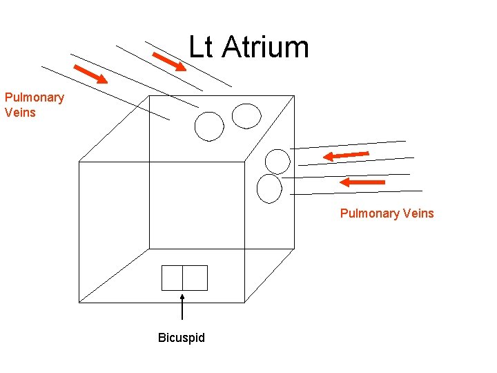 Lt Atrium Pulmonary Veins Bicuspid 