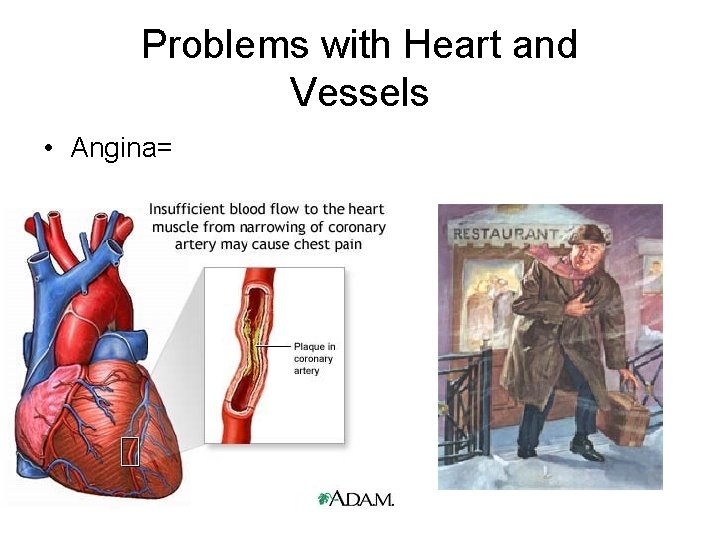 Problems with Heart and Vessels • Angina= 