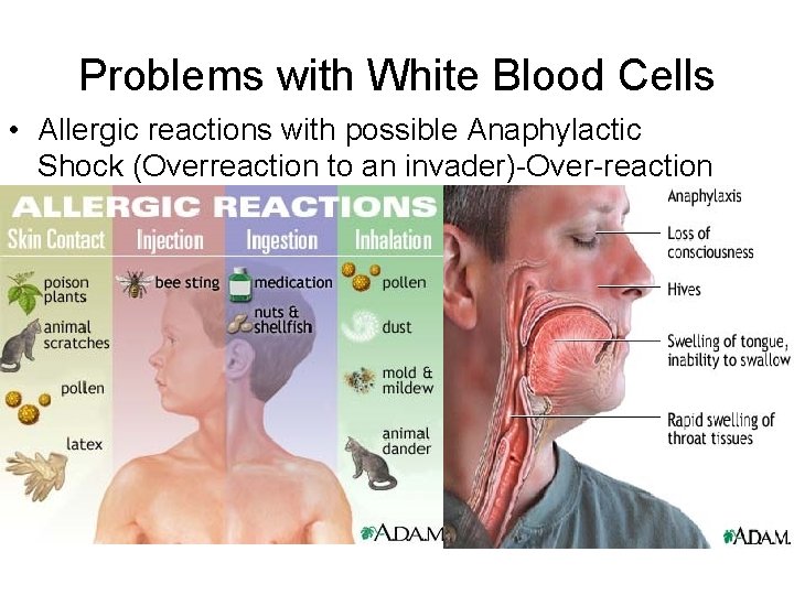 Problems with White Blood Cells • Allergic reactions with possible Anaphylactic Shock (Overreaction to