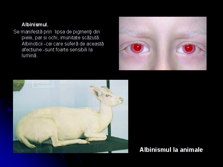 Albinismul. Se manifestă prin lipsa de pigmenţi din piele, par si ochi, imunitate scăzută.