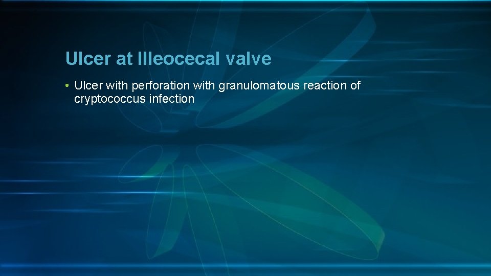 Ulcer at Illeocecal valve • Ulcer with perforation with granulomatous reaction of cryptococcus infection