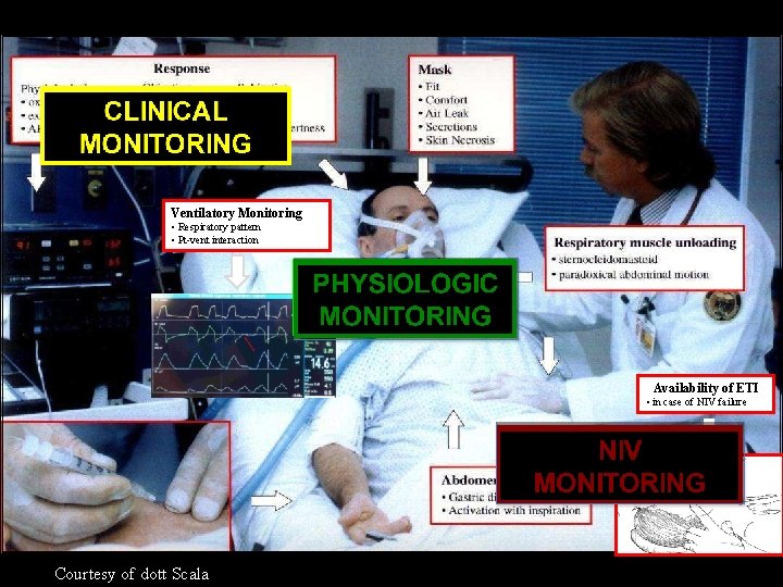 Ventilatory Monitoring • Respiratory pattern • Pt-vent interaction Availability of ETI • in case Ventilatory Monitoring • Respiratory pattern • Pt-vent interaction Availability of ETI • in case