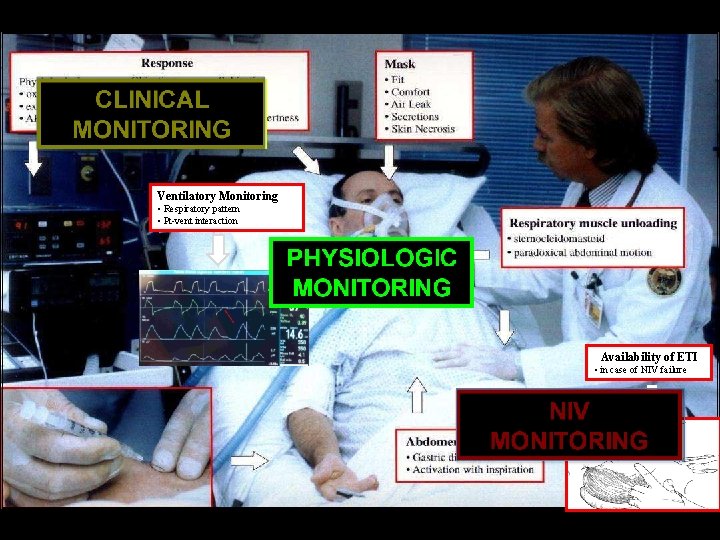 Ventilatory Monitoring • Respiratory pattern • Pt-vent interaction Availability of ETI • in case Ventilatory Monitoring • Respiratory pattern • Pt-vent interaction Availability of ETI • in case