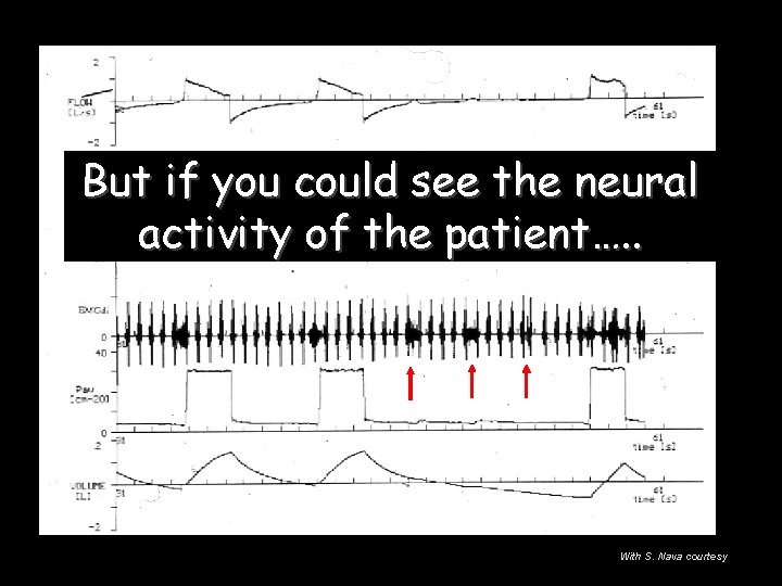 But if you could see the neural activity of the patient…. . With S. But if you could see the neural activity of the patient…. . With S.