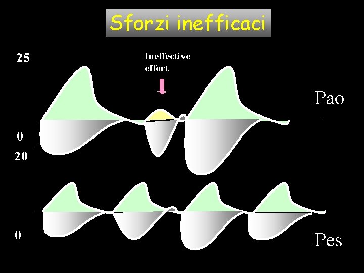 Sforzi inefficaci 25 Ineffective effort Pao 0 20 0 Pes Sforzi inefficaci 25 Ineffective effort Pao 0 20 0 Pes