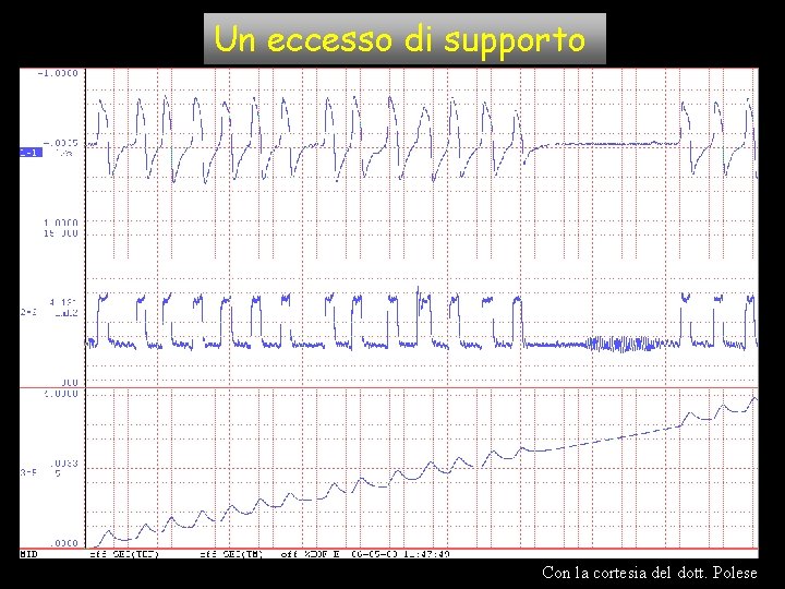 Un eccesso di supporto Con la cortesia del dott. Polese Un eccesso di supporto Con la cortesia del dott. Polese