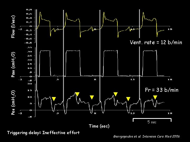 Flow (l/sec) Paw (cm. H 2 O) Vent. rate = 12 b/min Pes (cm. Flow (l/sec) Paw (cm. H 2 O) Vent. rate = 12 b/min Pes (cm.