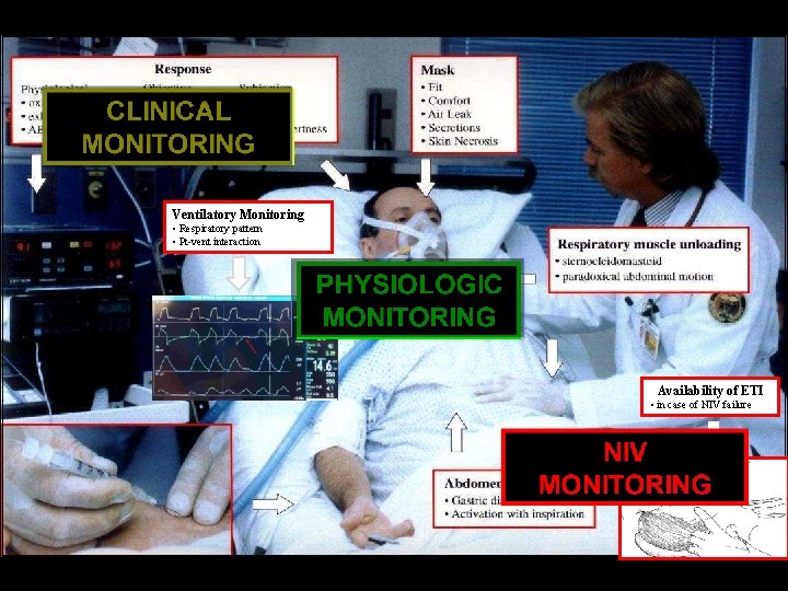 Ventilatory Monitoring • Respiratory pattern • Pt-vent interaction Availability of ETI • in case Ventilatory Monitoring • Respiratory pattern • Pt-vent interaction Availability of ETI • in case