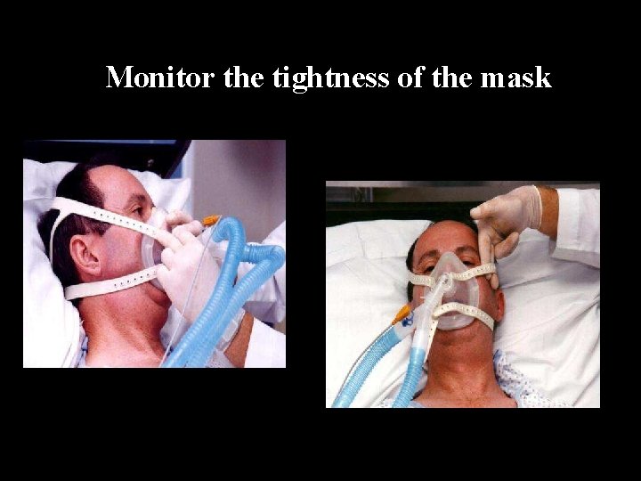 Monitor the tightness of the mask Monitor the tightness of the mask