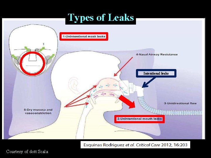 Types of Leaks Intentional leaks Courtesy of dott Scala Types of Leaks Intentional leaks Courtesy of dott Scala
