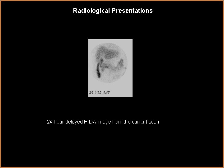 Radiological Presentations 24 hour delayed HIDA image from the current scan 