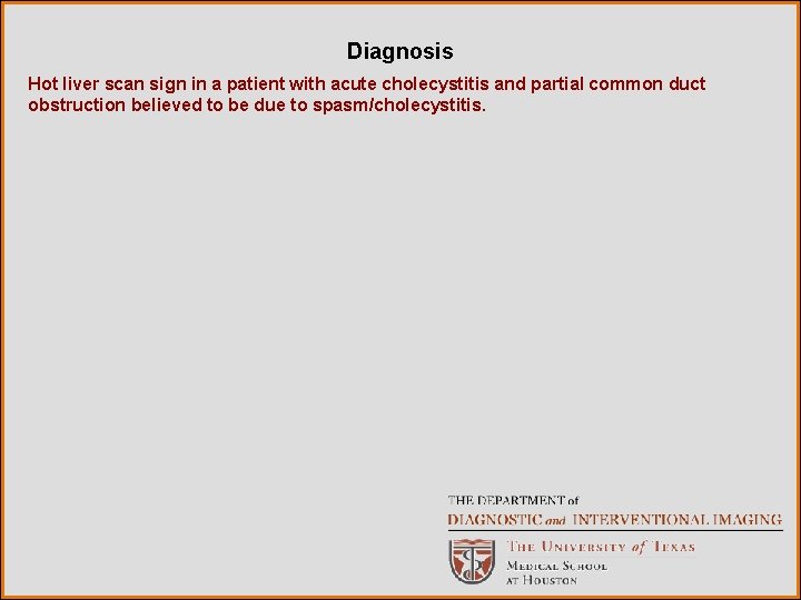 Diagnosis Hot liver scan sign in a patient with acute cholecystitis and partial common