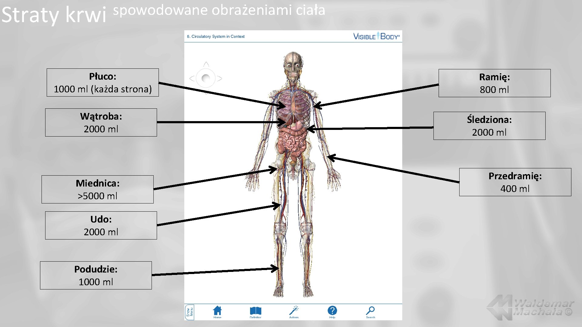 Straty krwi spowodowane obrażeniami ciała Płuco: 1000 ml (każda strona) Wątroba: 2000 ml Miednica: