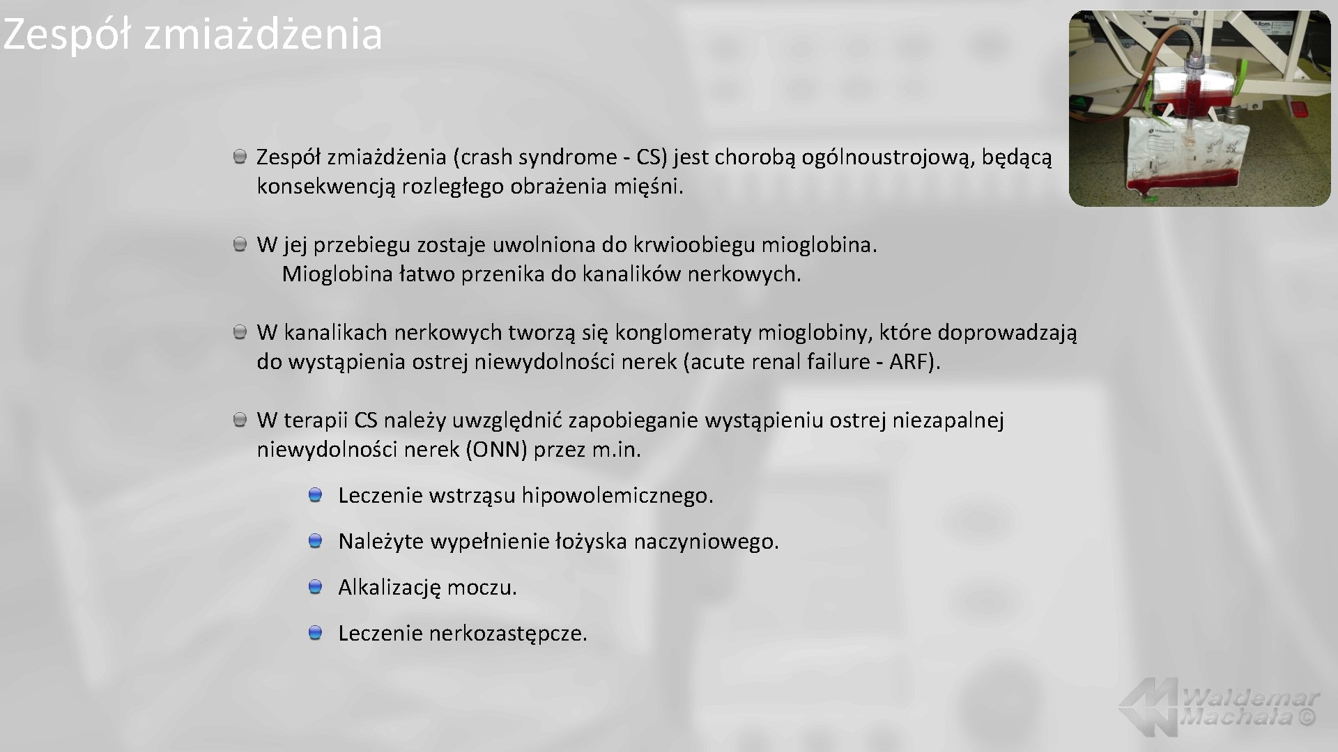 Zespół zmiażdżenia (crash syndrome - CS) jest chorobą ogólnoustrojową, będącą konsekwencją rozległego obrażenia mięśni.