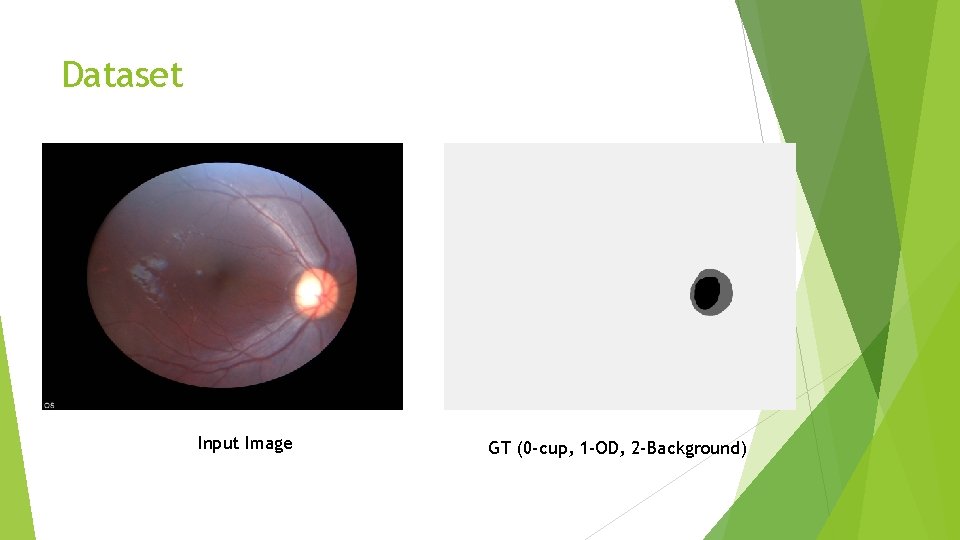 Dataset Input Image GT (0 -cup, 1 -OD, 2 -Background) Dataset Input Image GT (0 -cup, 1 -OD, 2 -Background)